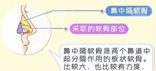 上海李健隆鼻怎么样