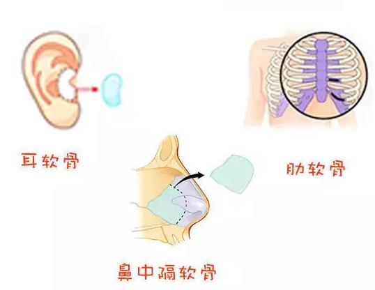 宋茂啟做鼻子多少錢