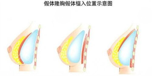 福建省立医院整形外科丁力医生怎么样