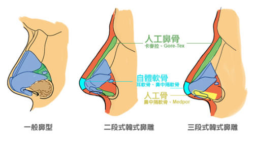 freezia宋智雅的鼻子是做的嗎