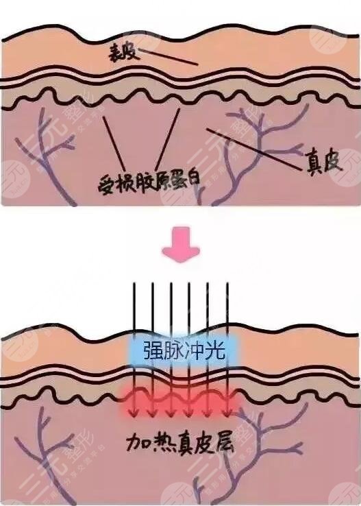 做熱瑪吉可以保持多久