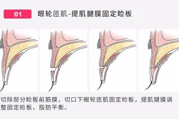 惠州整形医院排名前十