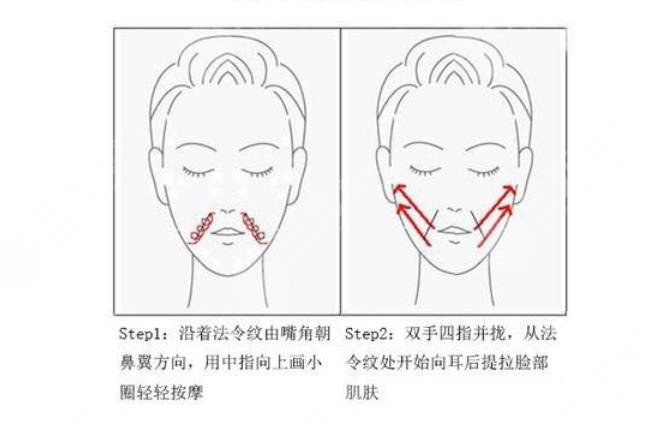 怎么消除法令紋