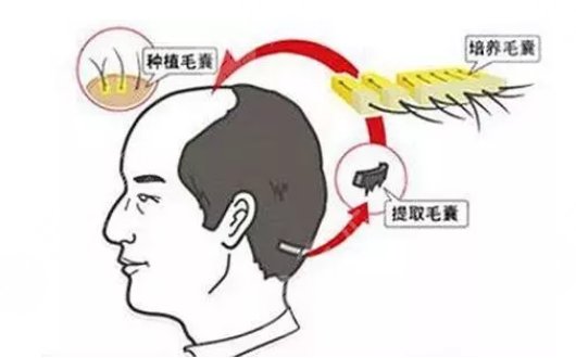 南方醫(yī)科大學南方醫(yī)院植發(fā)醫(yī)生排名榜