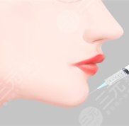 武漢新至美玻尿酸墊下巴美麗日記分享