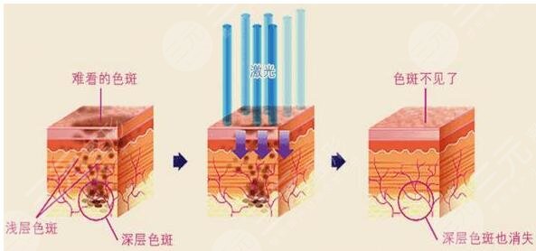 深圳北大医院整形美容科怎么样有什么项目