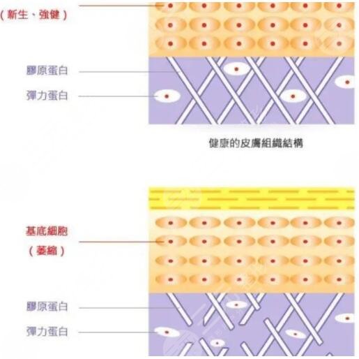 賽諾秀5D膠原光和賽諾龍5Gmax極速提拉效果一樣嗎