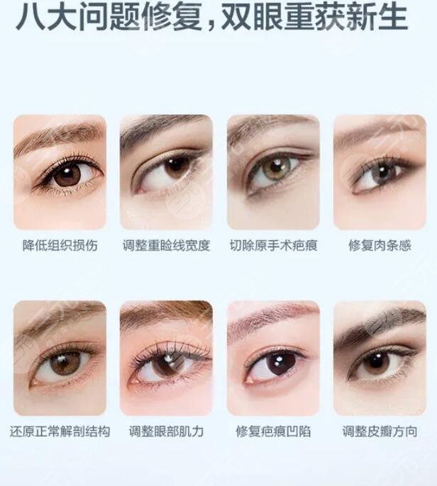 郑州双眼皮修复排行榜