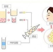 深圳做脂肪填充好的醫(yī)生名單-哪個醫(yī)生果好