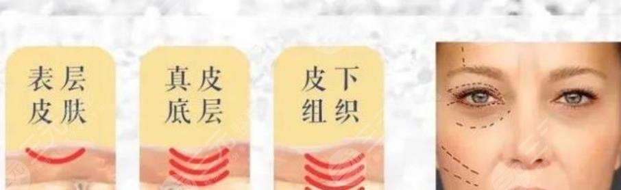 賽諾龍5gmax極速提拉