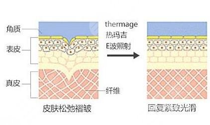 熱瑪吉有什么果和副作用