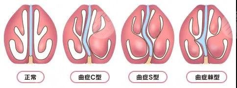 歪鼻星靠P圖治標(biāo)不治本