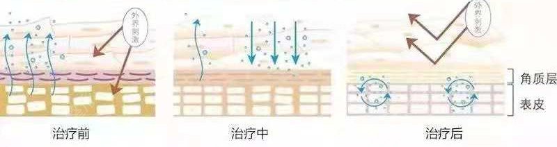 滄州中心醫(yī)院激光祛斑多少錢