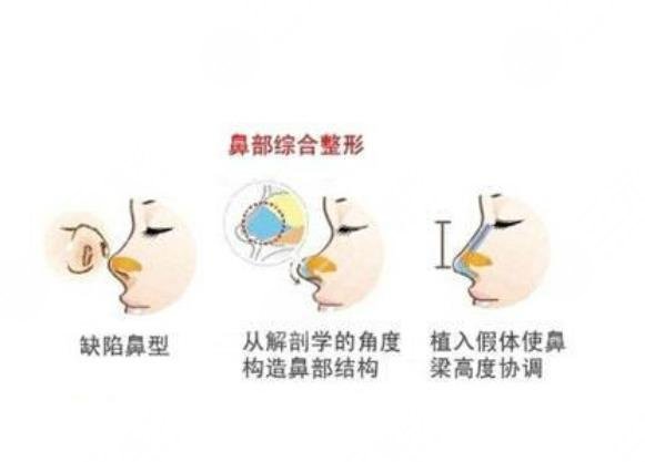 宁波郭光烨做鼻子的风格是什么