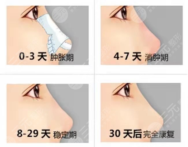 北京八大处双眼皮修复专家名单