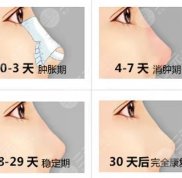 重慶珂琳雅王陳技術(shù)怎么樣