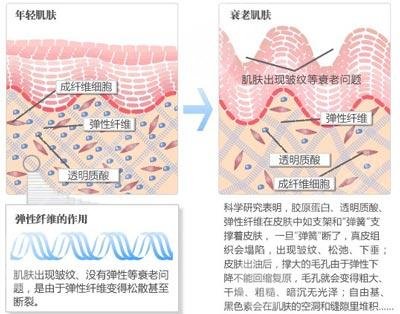 生物注射除皺價格是多少