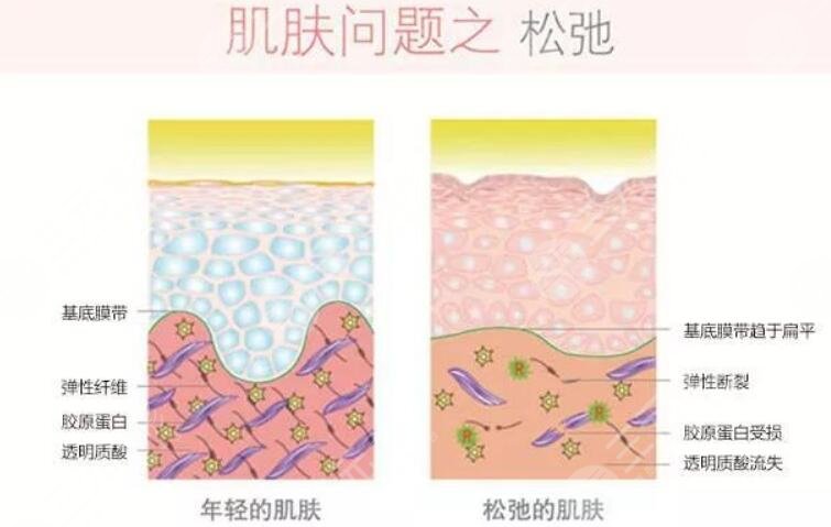 賽諾秀5d膠原光和熱瑪吉區(qū)別是什么