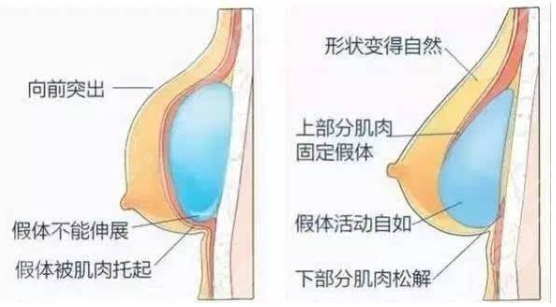 魏家賓和趙善軍做胸誰(shuí)好