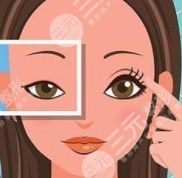 長沙龍劍虹割雙眼皮風(fēng)格是什么