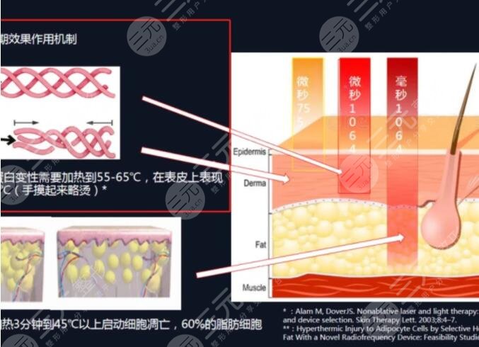 賽諾秀5d膠原光和熱瑪吉區(qū)別抗衰必看