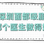 深圳面部吸脂哪個醫(yī)生做得效果好