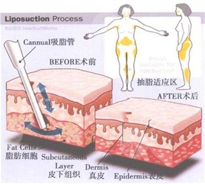 尹時允整容前后照片