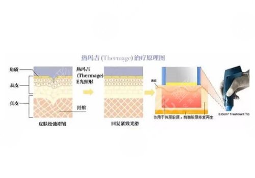 面部抗衰tips