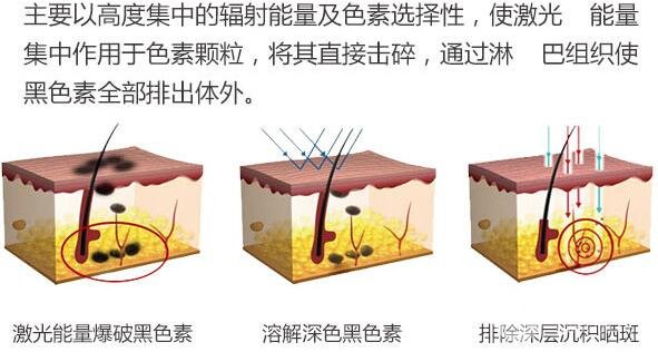 宝鸡中心医院激光美容点痣怎么样