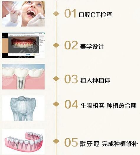 中国大型良好的种植牙医院排行榜