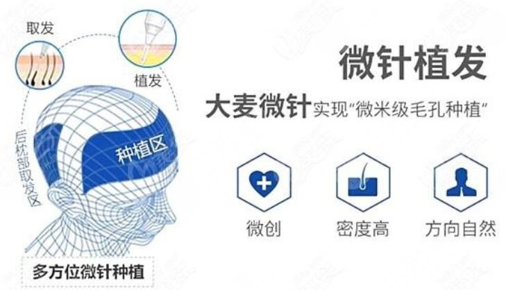 2022北京植发正规医院名单出炉