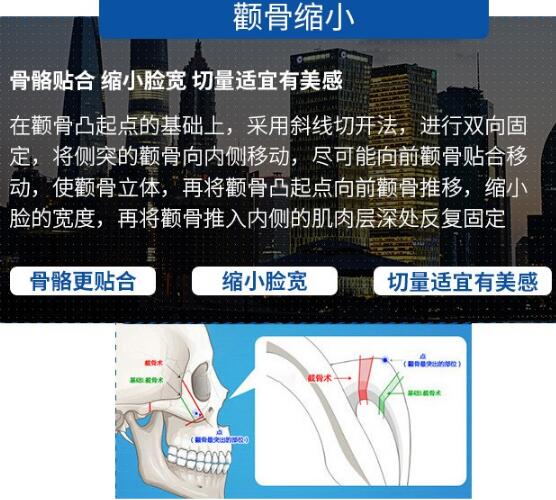 上海脸部轮廓整形医院哪个好