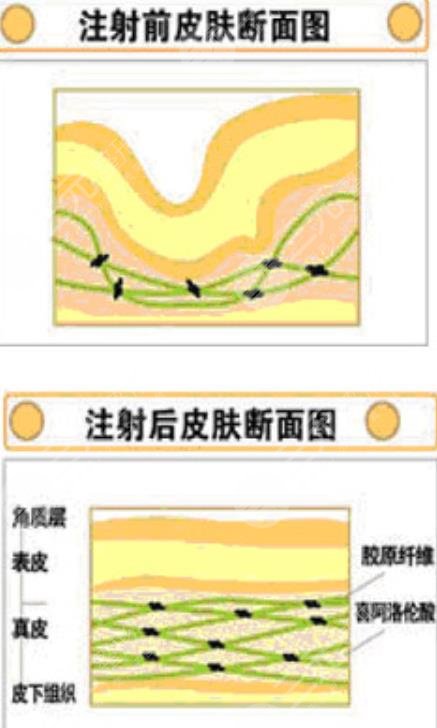 八大处激光美容中心哪个大夫好