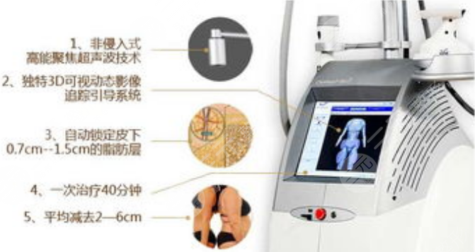 超脂塑溶脂比傳統(tǒng)吸脂手術(shù)的優(yōu)勢(shì)在哪里