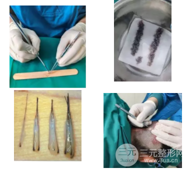 重庆西南医院植发手术挂什么科—正规三甲都在这个科室