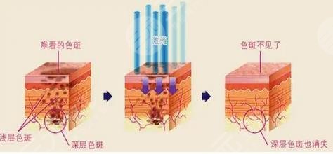 广东省皮肤病医院美容科哪个医生好