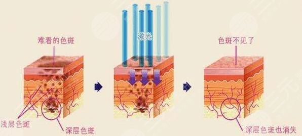 西京醫(yī)院魯開化醫(yī)生怎么樣