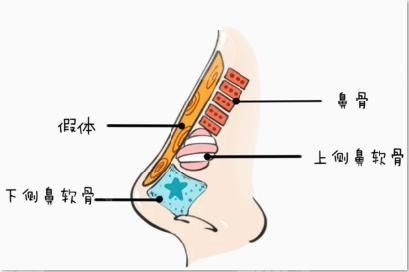 王先成醫(yī)生擅長哪個方面的整形手術