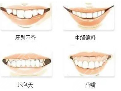 矯正牙齒的危害有哪些