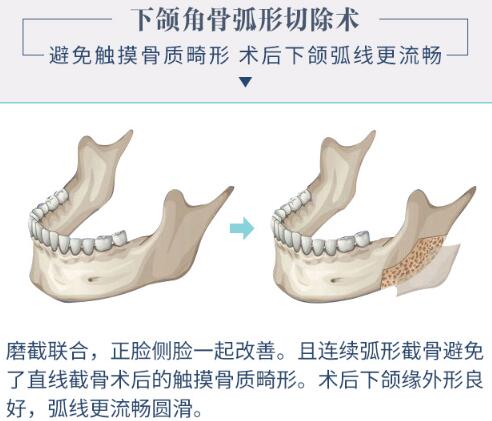 沈紹勇改臉型怎么樣