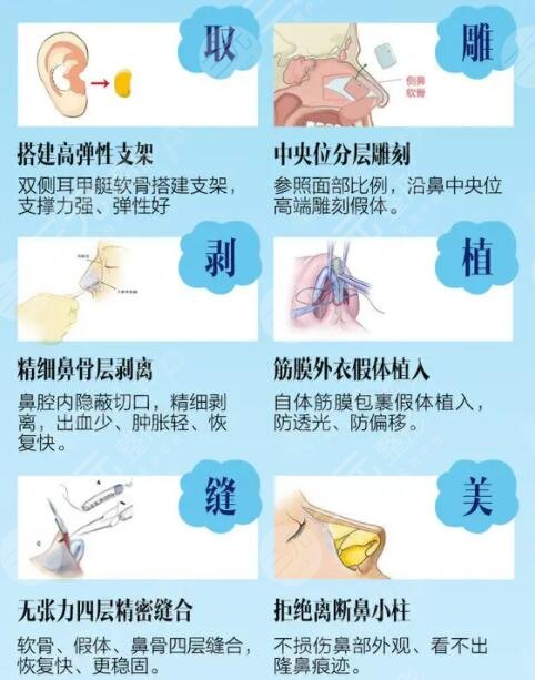 為什么韓式三段隆鼻不推薦做