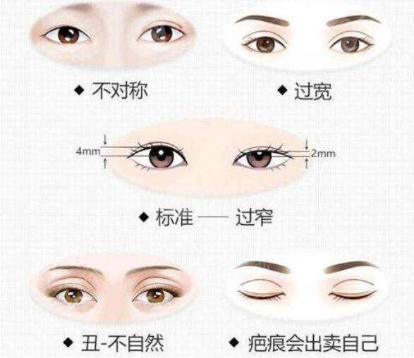 上海做双眼皮修复好的医生是哪位