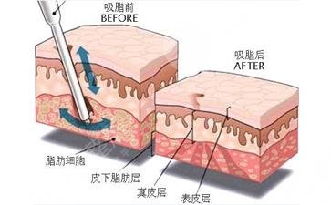 跑步減肥的正確方法全面GET