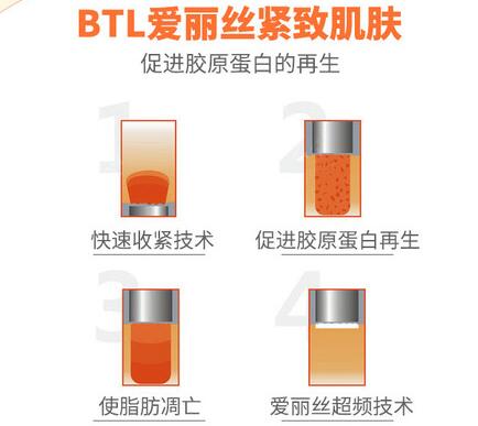 btl射频溶脂成好吗