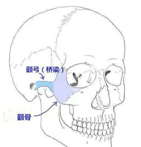 于國東降顴骨怎么樣