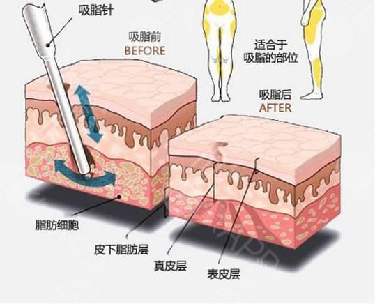 上海翡立思医疗陈立彬怎么样