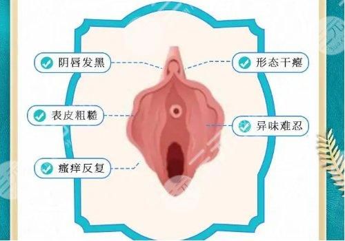 歐洲之星私密點(diǎn)陣激光價(jià)位是多少