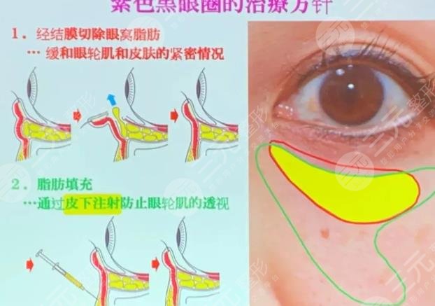 2022年“墜”新解壓神器來咯