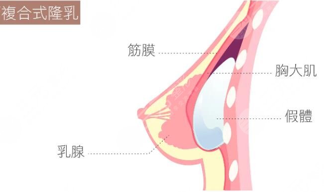 黃名斗做胸技術(shù)怎么樣