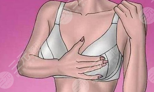 棉花糖隆胸真的可以预防包膜挛缩吗